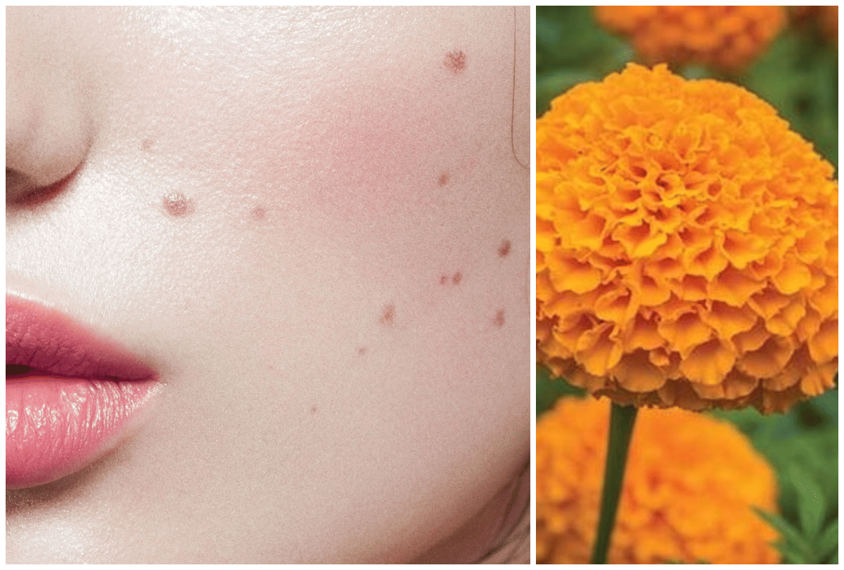 marigold flower uses benefits for health and skin