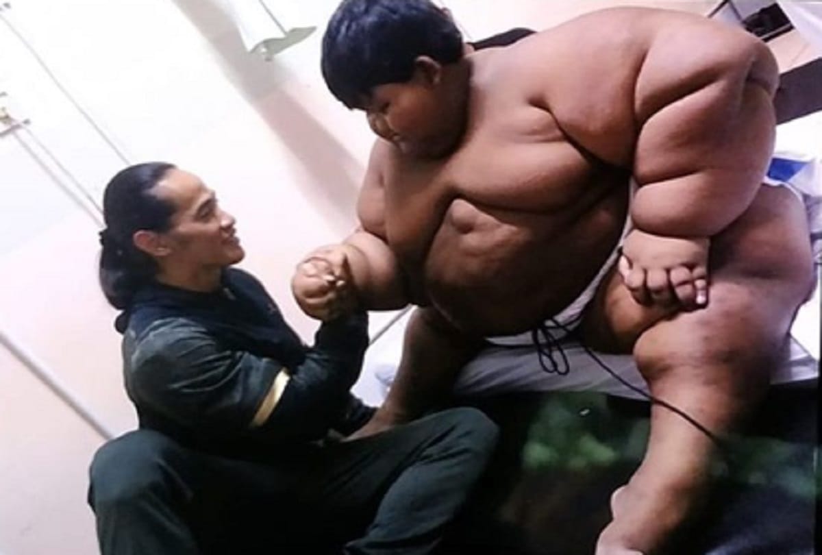 worlds fattest boy Arya Permana lost 110 kg weight in just 4 years