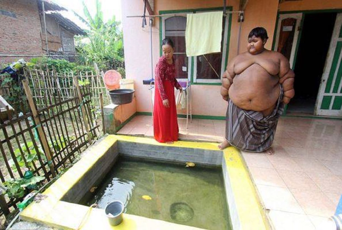 worlds fattest boy Arya Permana lost 110 kg weight in just 4 years