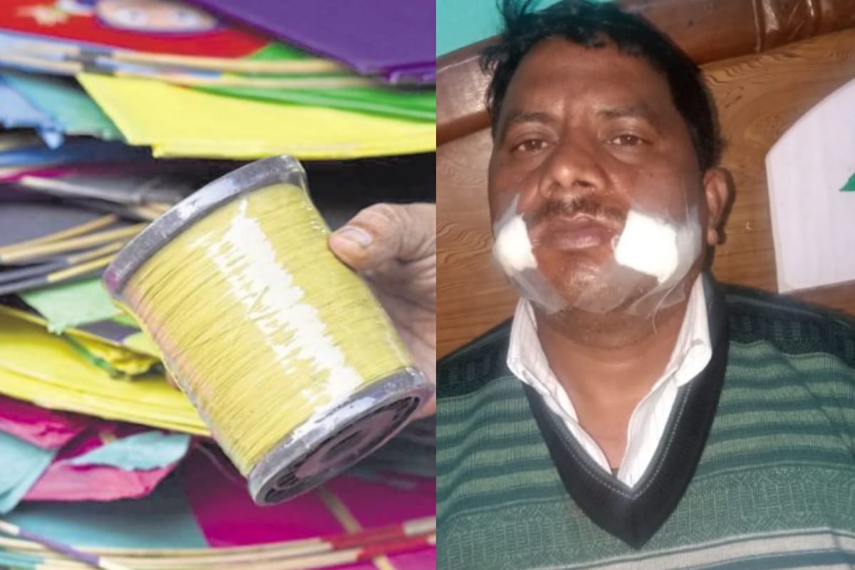 Three injured from Chinese Manjha including younger brother of councilor in saharanpur