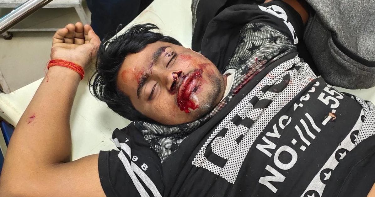 Four injured in a clash of bikes