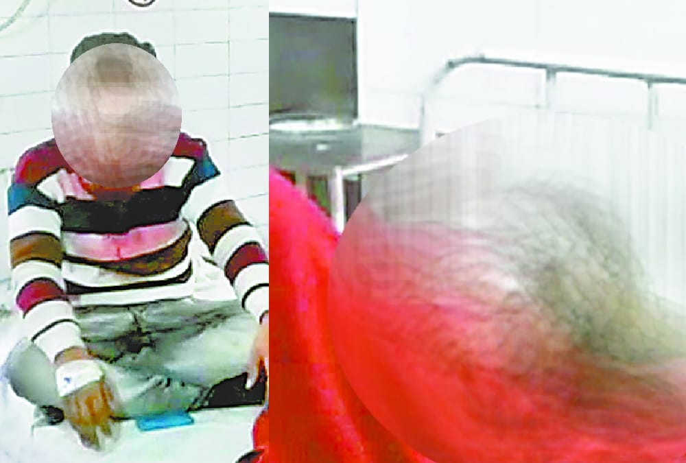 People cuts nose of a man and woman in Ayodhya.