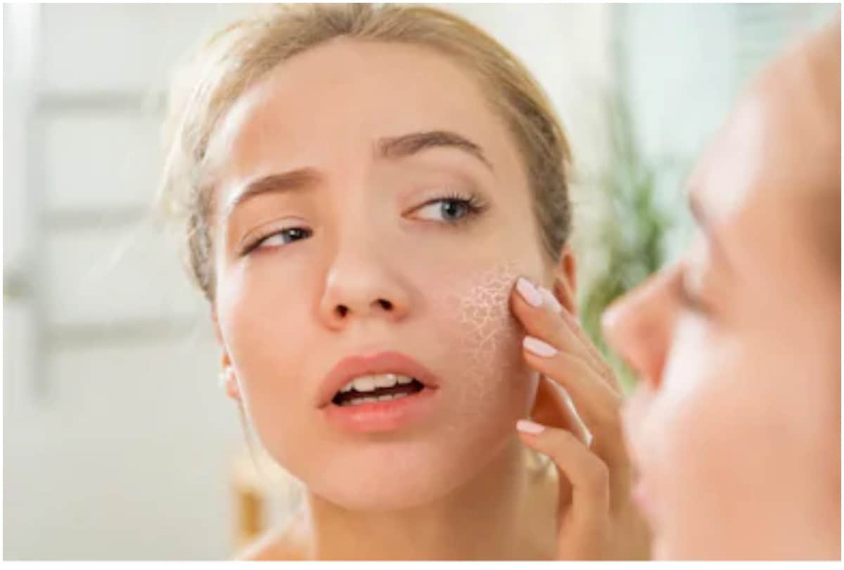 winter skin care apply home made pack instead of soap for soft and smooth skin