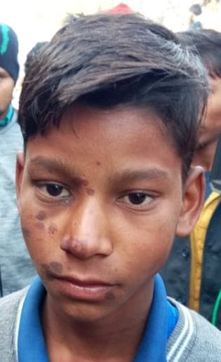 Vineet handled terror in children due to bullet and bomb
