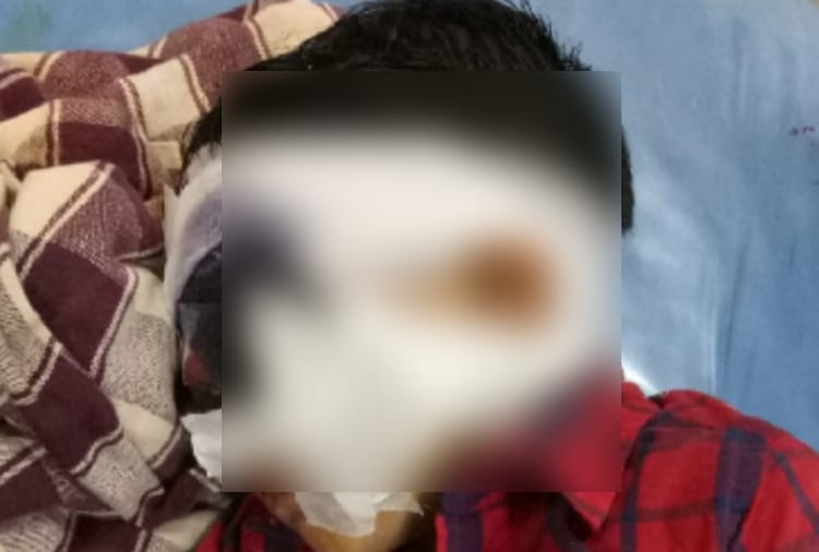 A Woman and two child injured in dogs attacks