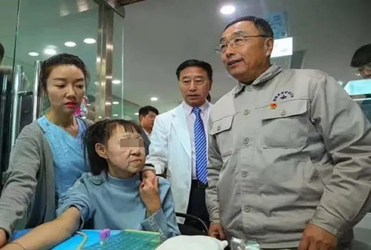 15 years old Girl looked like she was 60 surgery gives her a new face