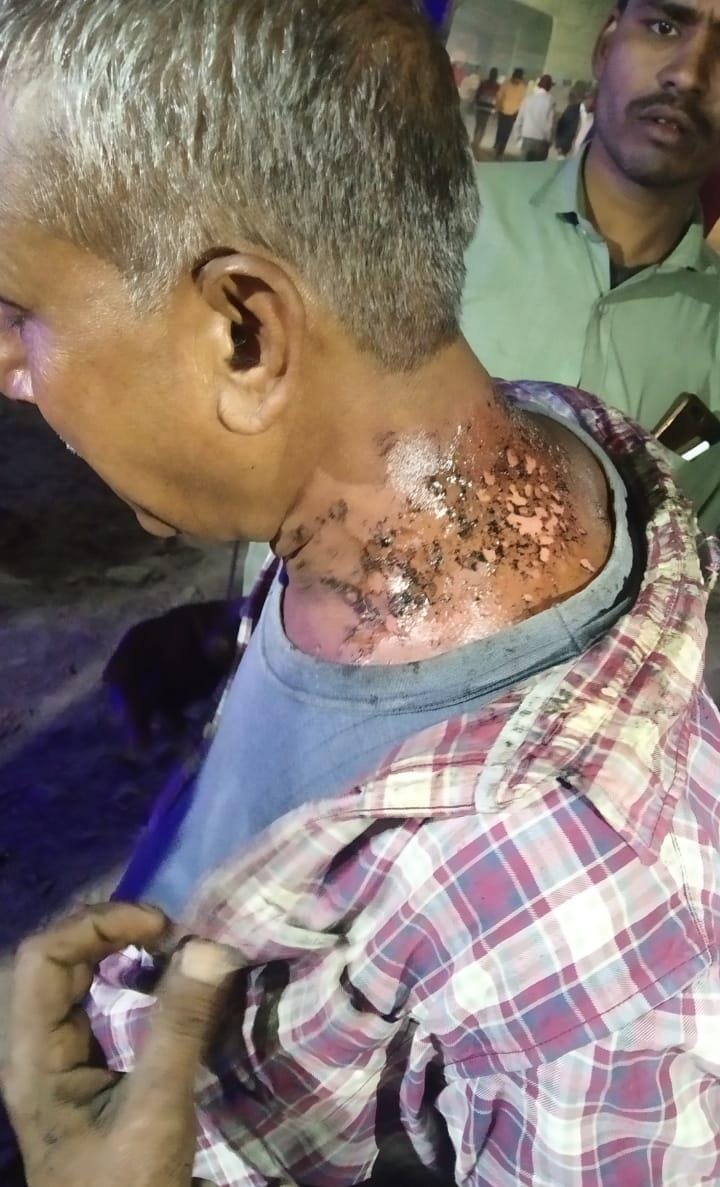 Negligence in construction of Varanasi's biggest flyover, two people scrambled to fall