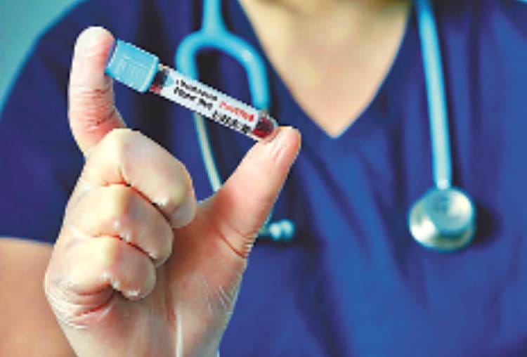 three samples of corona virus sent to KGMU for check up