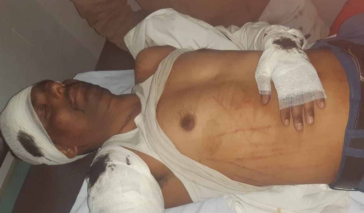 Councilor attacked due to strike, beaten fiercely