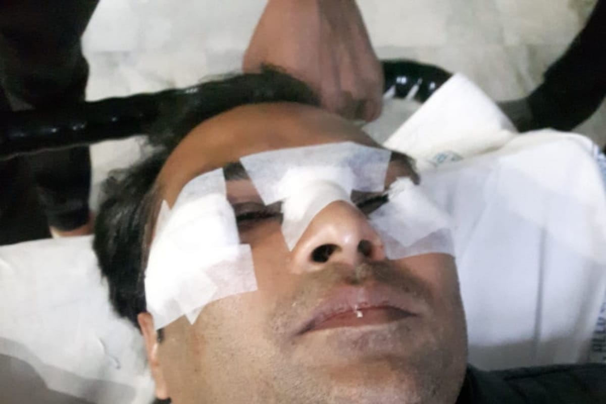 Youth injured in Prayagraj being hit by Chinese men
