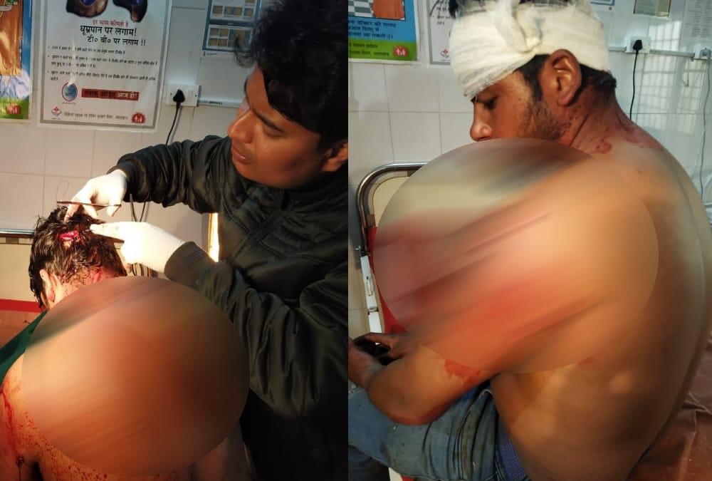 Bear Attack on Youth in nainital Ramgarh