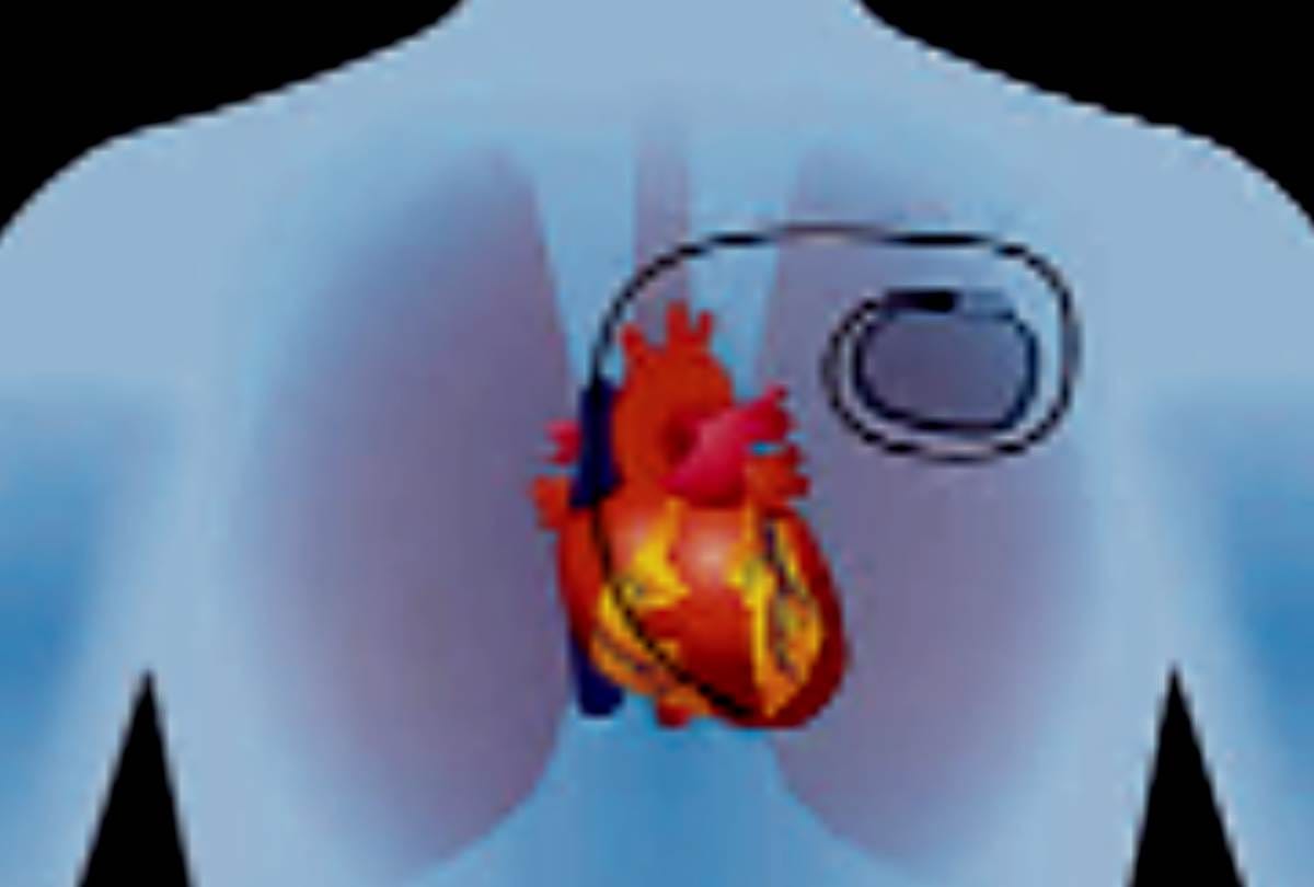 cardiologists spoke on heart disease and its treatments in lucknow