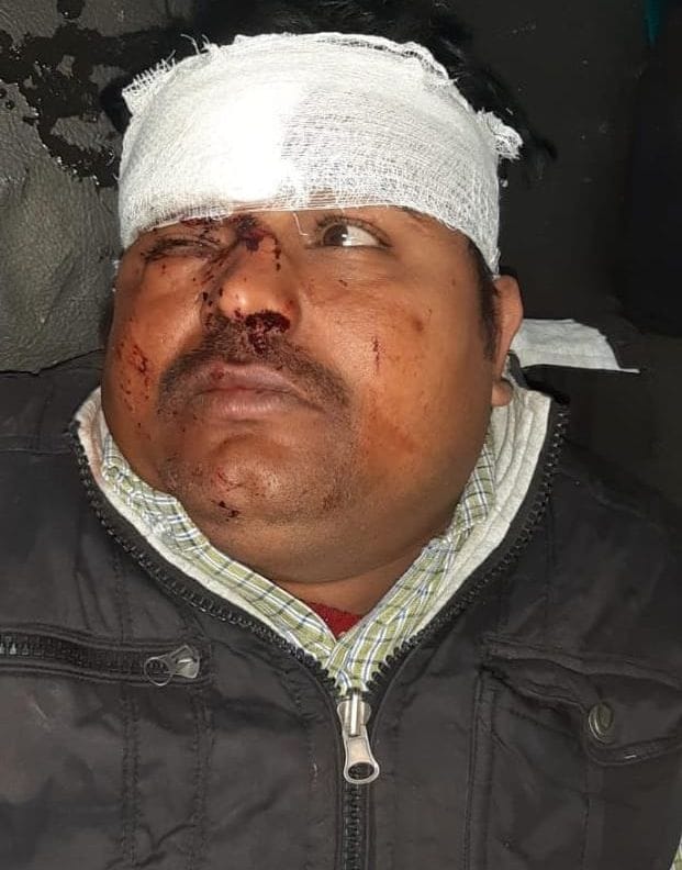 Uncontrolled truck collides with Vikram, 10 injured