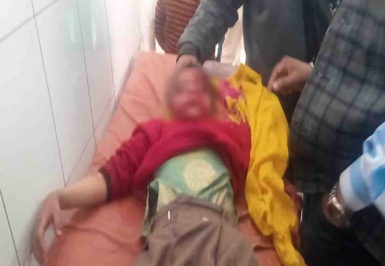 Girl injured by dog bite in hardoi