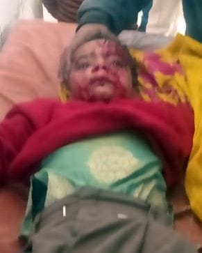 The dog attacked the student and scratched her mouth