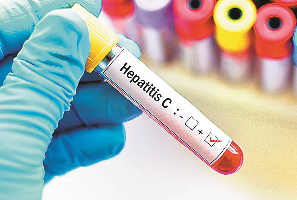 carelessness in dialysis making people patient of Hepatitis- C