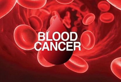 doctor told In a program in Agra why cases of blood cancer are increasing rapidly in children