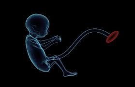 Infant dies in womb, doctor unaware