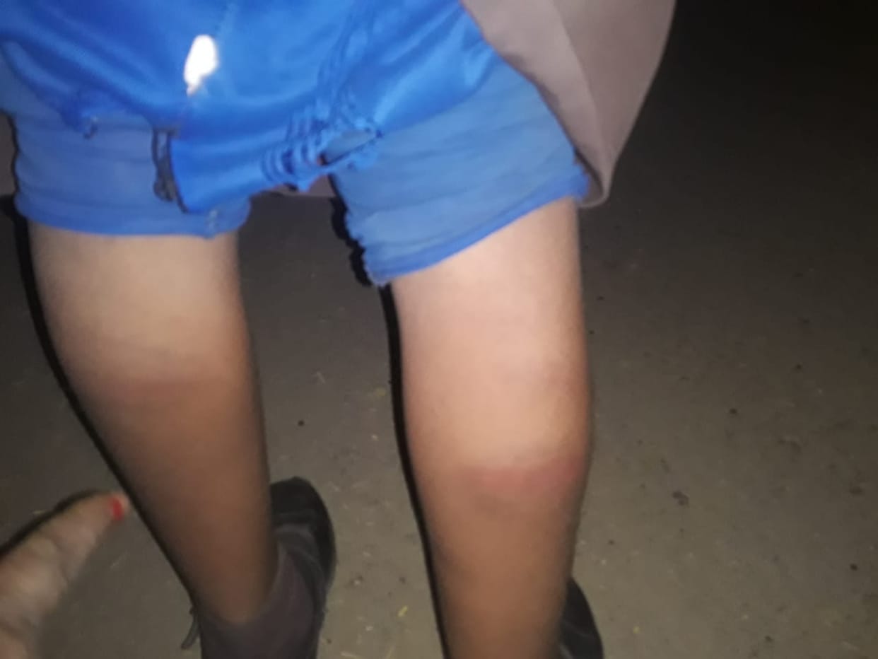 Beaten girls student fear for going to school