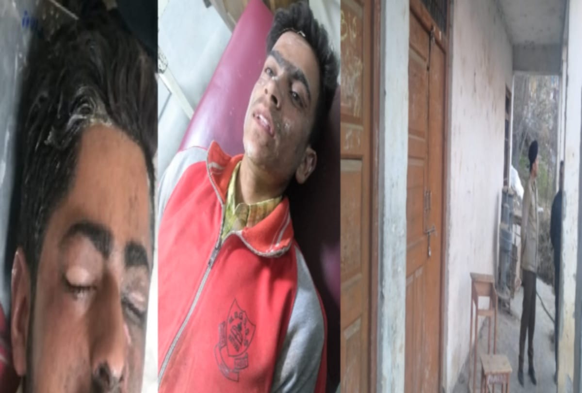Explosion in lab during chemistry practicals in govt school,  four students scorched