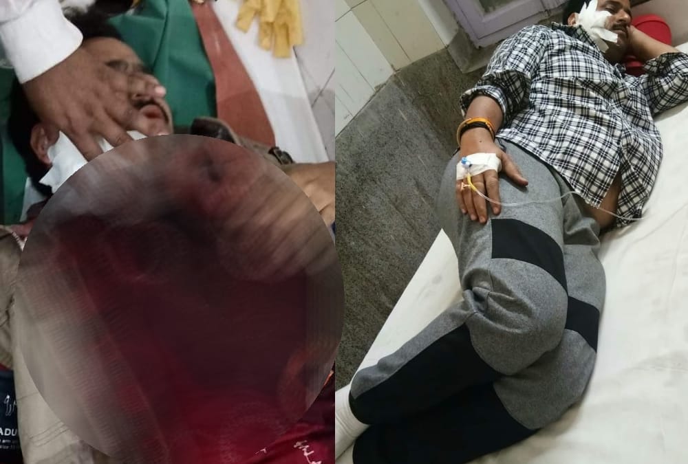 Attack on senior BJP leader shesh narayan mishra son.