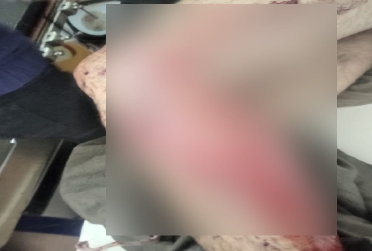 quarrel erupted while spraying apple in the garden, elder brother fired on younger one