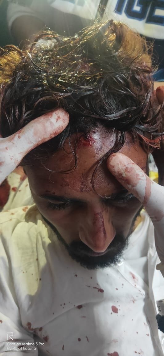 firings in two group, four injured