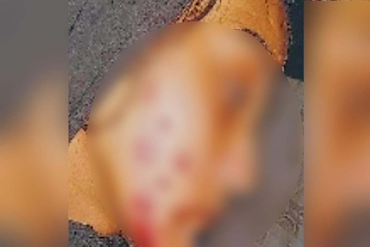 Meerut Man burned his wife face with cigarette