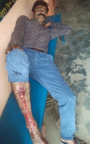 Police anger over Tempo, leg broken