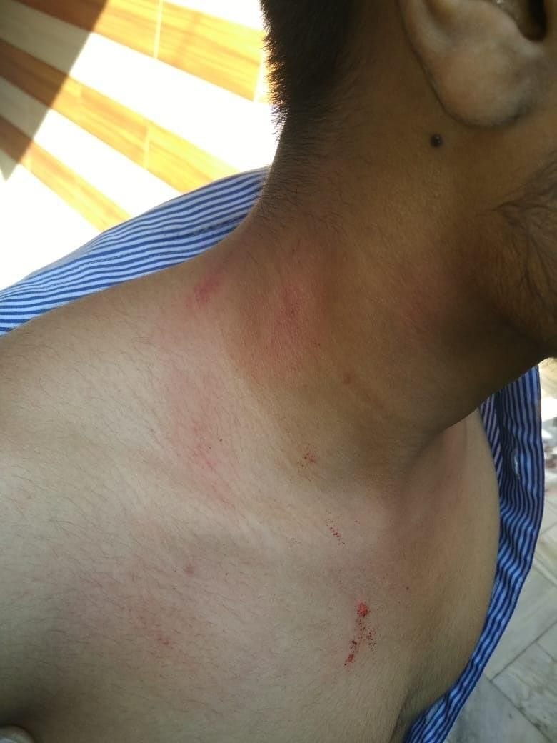 iti teachers accuses student of assault