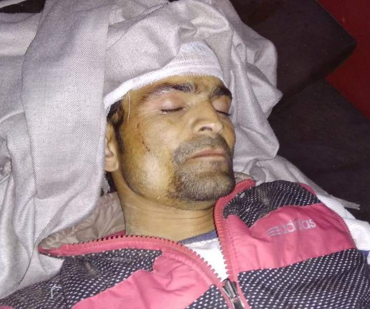 House visor fell, Kanwariya and six children injured