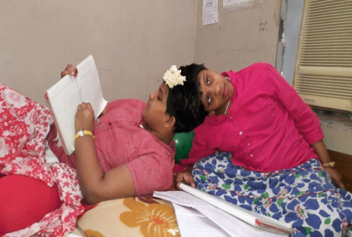 hyderabad conjoined twins got permission to give 10th class exam seperately