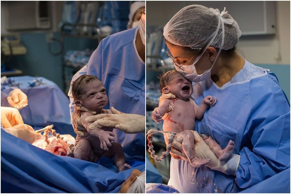 Brazil rio de janeiro Isabela Pereira Before cutting the umbilical cord newborn stared at the doctor