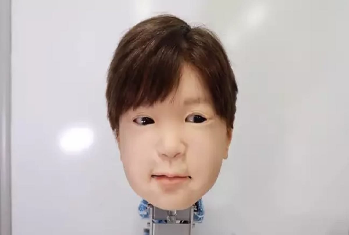 Scientists In Japan Unveil Unique Robot That Can Feel Pain