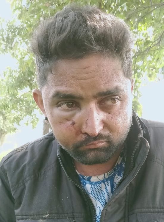 Man looted and Injured By Three