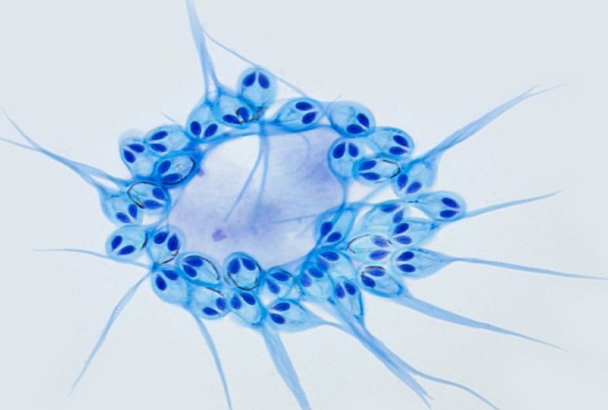 parasite like jellyfish mysterious creature of the world who can live without breathing