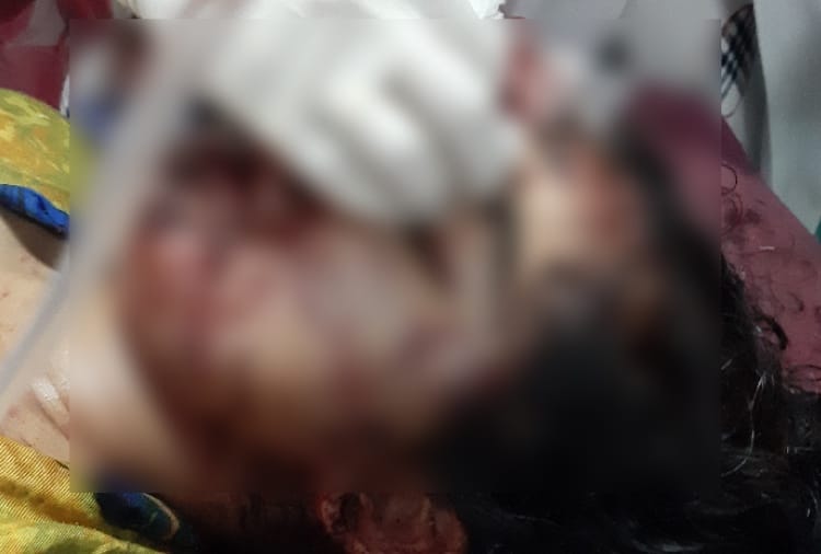 Former student attacked on woman teacher with sharp weapon in Khanna