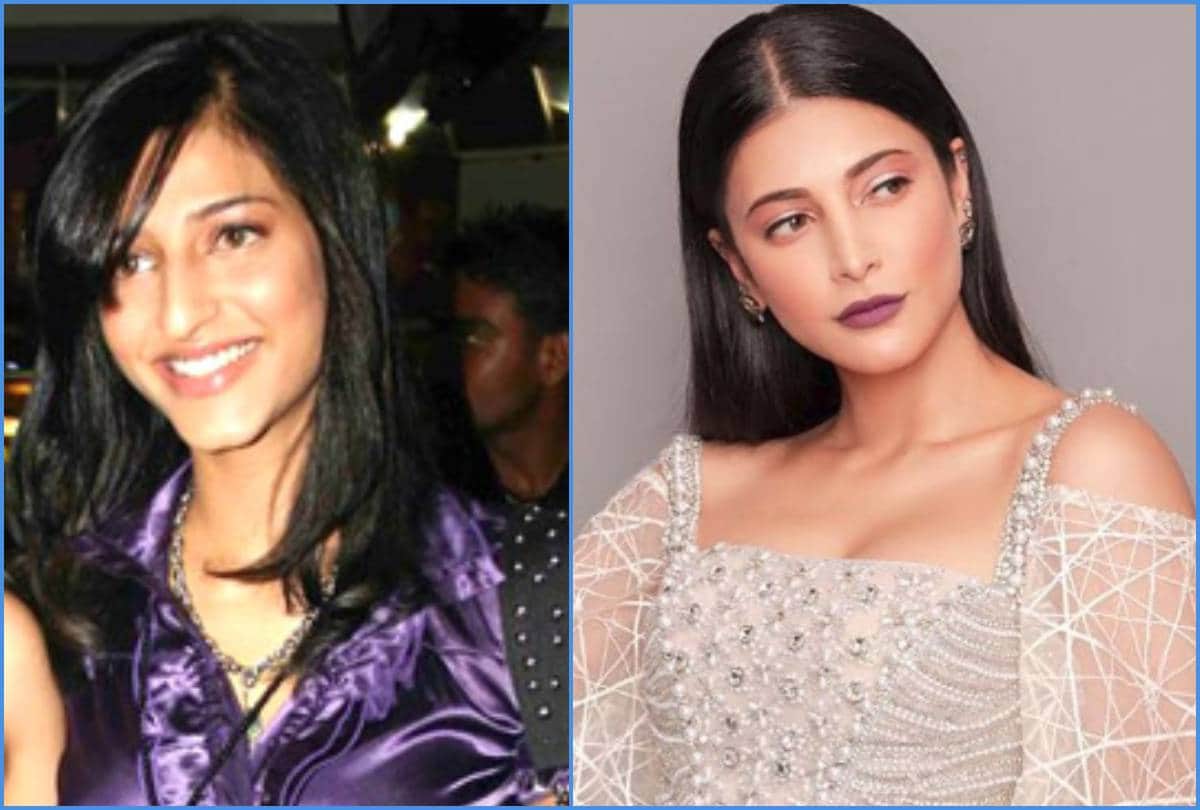 shruti haasan accepted she has plastic surgery