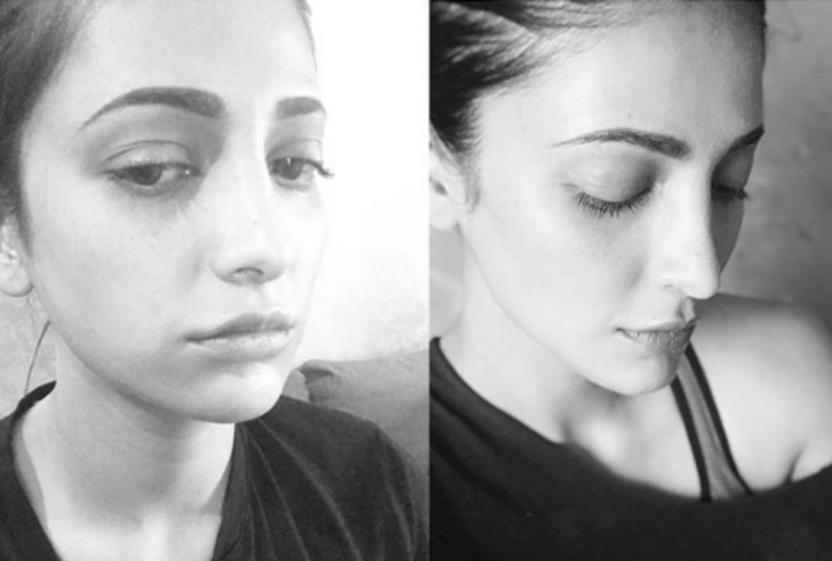 shruti haasan accepted she has plastic surgery
