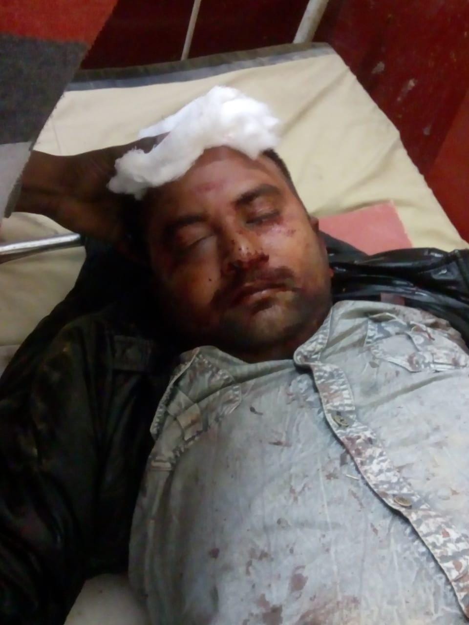 The young man who came to the Tilak ceremony was beaten with sticks