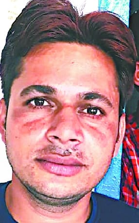 History Sheeter Karan did not die due to police bullet