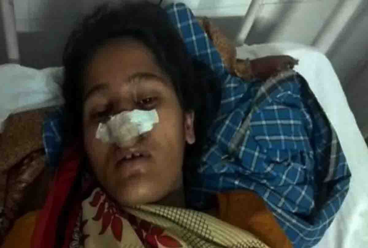 Husband cuts wife's nose with angry teeth