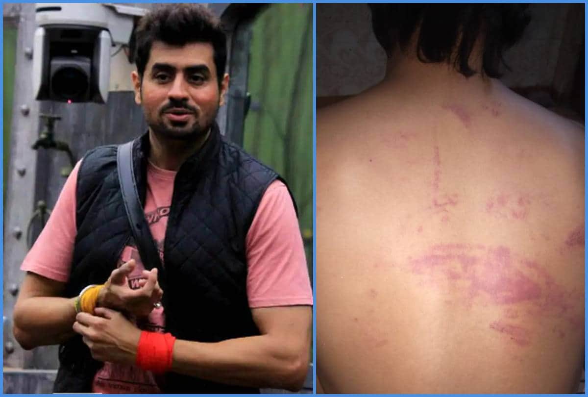 Bigg Boss 8 contestant Pritam Singh brutally beaten by goons for rescuing a couple