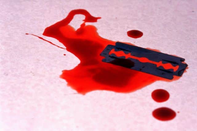 Youth in police custody in Prayagraj severed neck with blade, stirred up