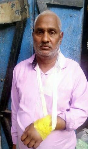 Hathras: Broken villager's hand bone in stray bull attack