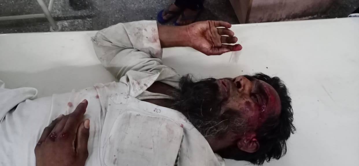 18 workers injured, four serious in road accident