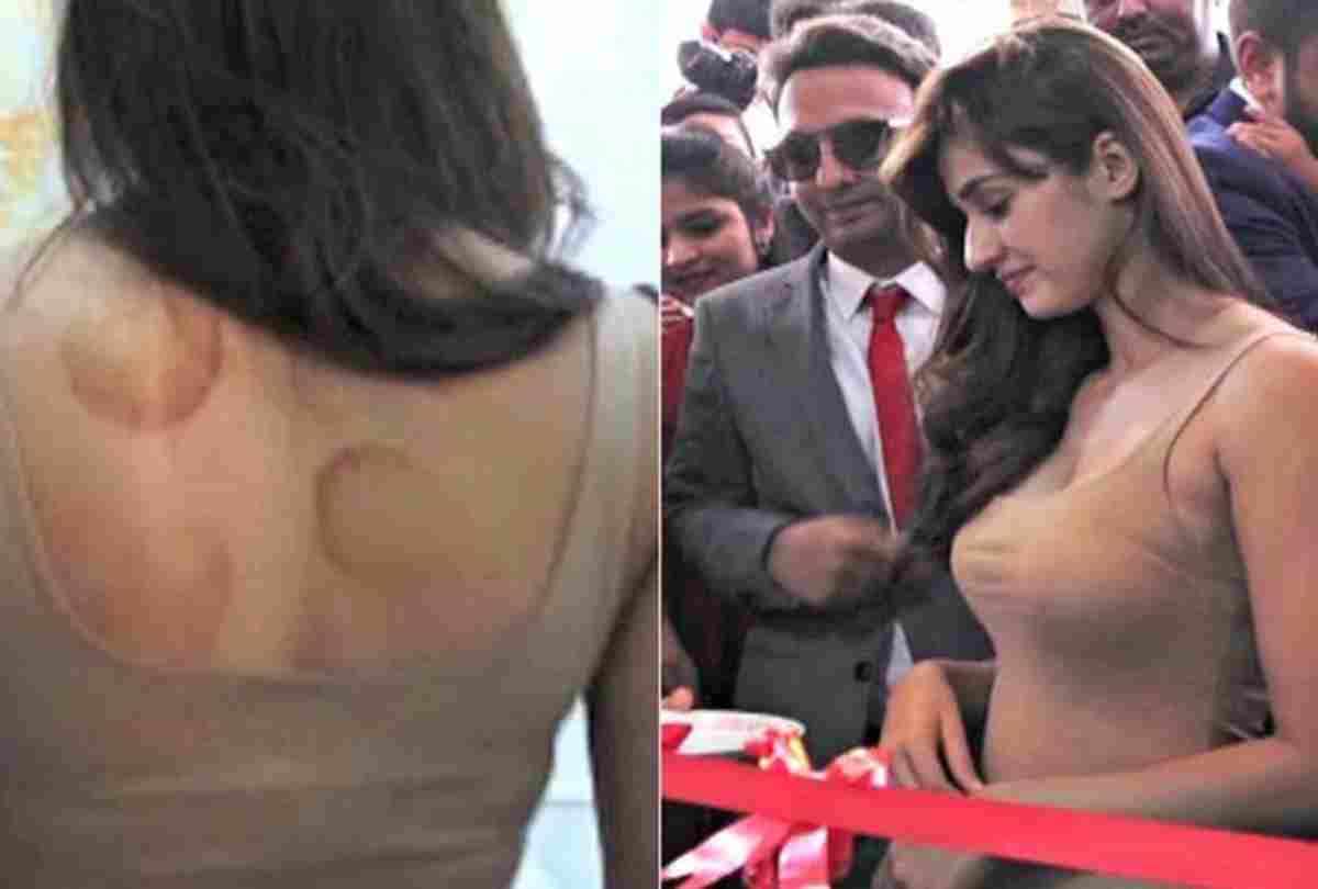disha patani old video viral spotted with cupping therapy marks