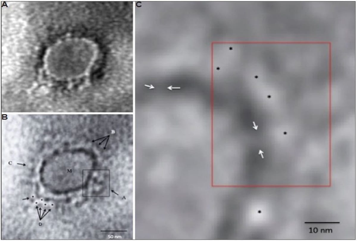 Coronavirus is neither a living organism nor it dies Covid 19 Structure is Protein Molecules DNA