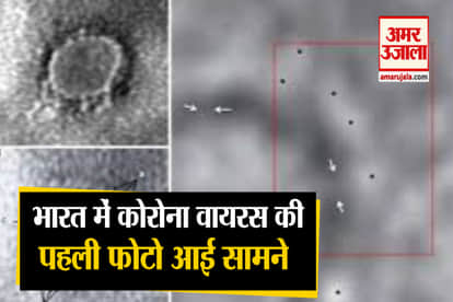 microscopic image of corona virus by indian scientists covid 19