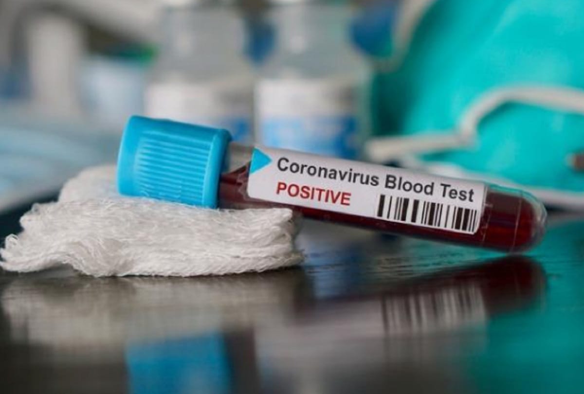 coronavirus andhra pradesh government to track phones of those who are quarantine know about it